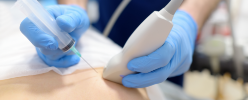 Biopsja Gliwice cienkoigłowa piersi